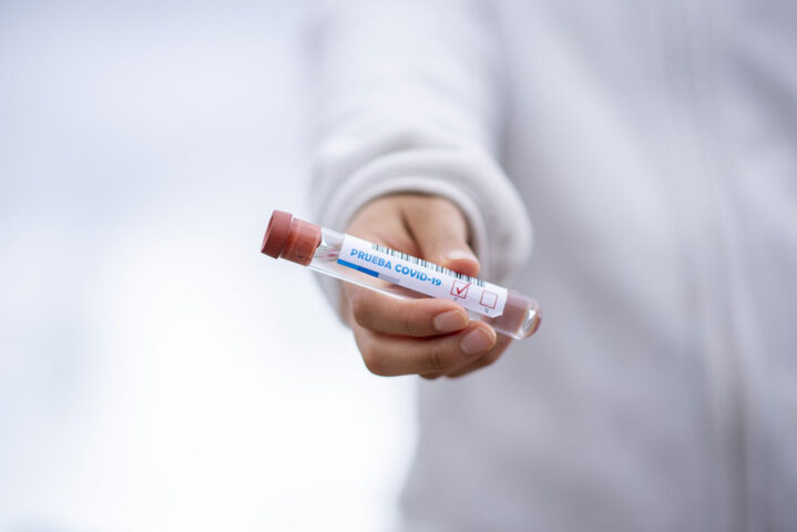 Coronavirus (Covid-19) test lab